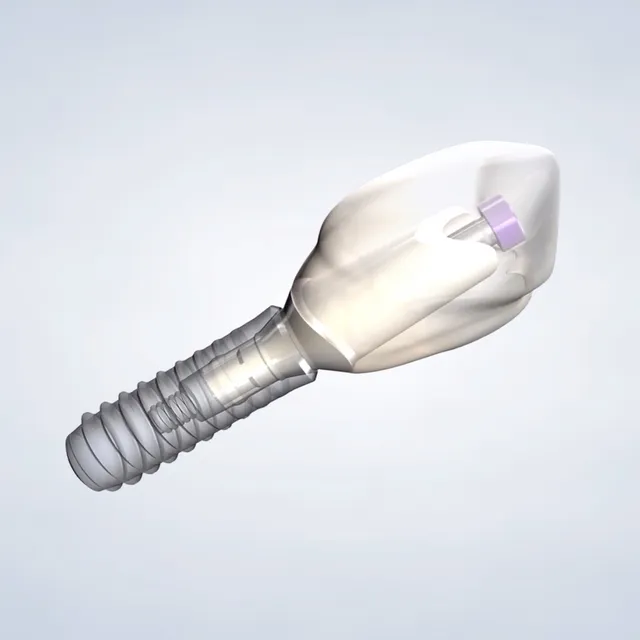 Query  dental implants